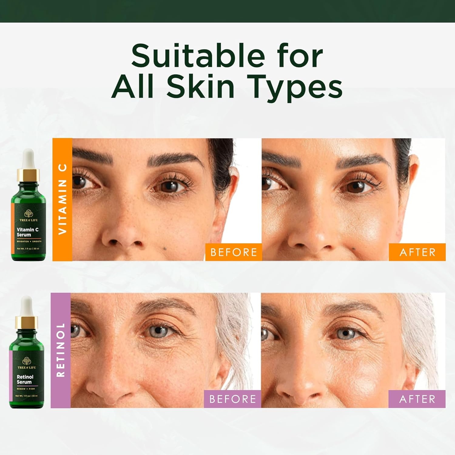 image:imageFacial Skin Care Set Brightening Firming Hydrating Dry Face Dermatologist Tested Retinol Serum and Hydrating Hyaluronic Acid Skin Care Kit 2 count of 1 Fl OzAdvanced Regimen Duo