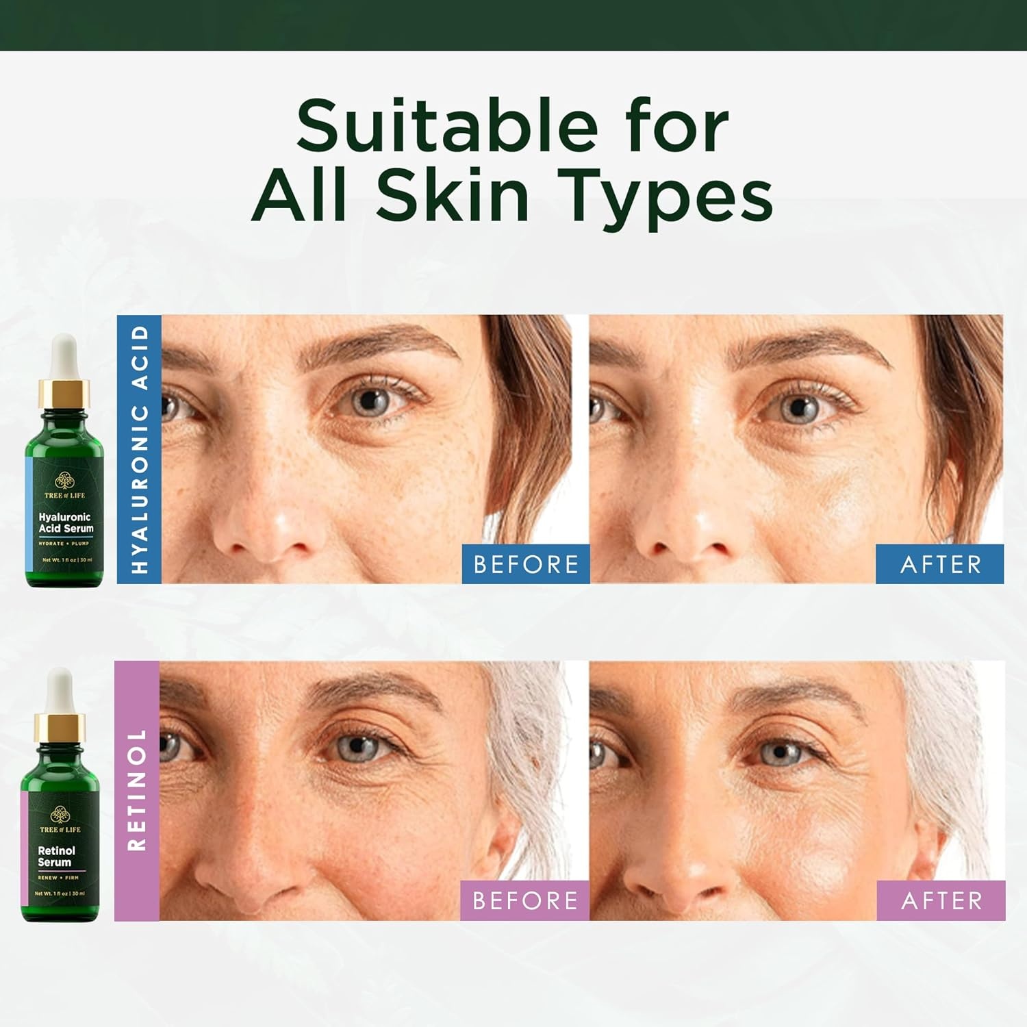 image:imageFacial Skin Care Set Brightening Firming Hydrating Dry Face Dermatologist Tested Retinol Serum and Hydrating Hyaluronic Acid Skin Care Kit 2 count of 1 Fl OzFacial Serum Duo