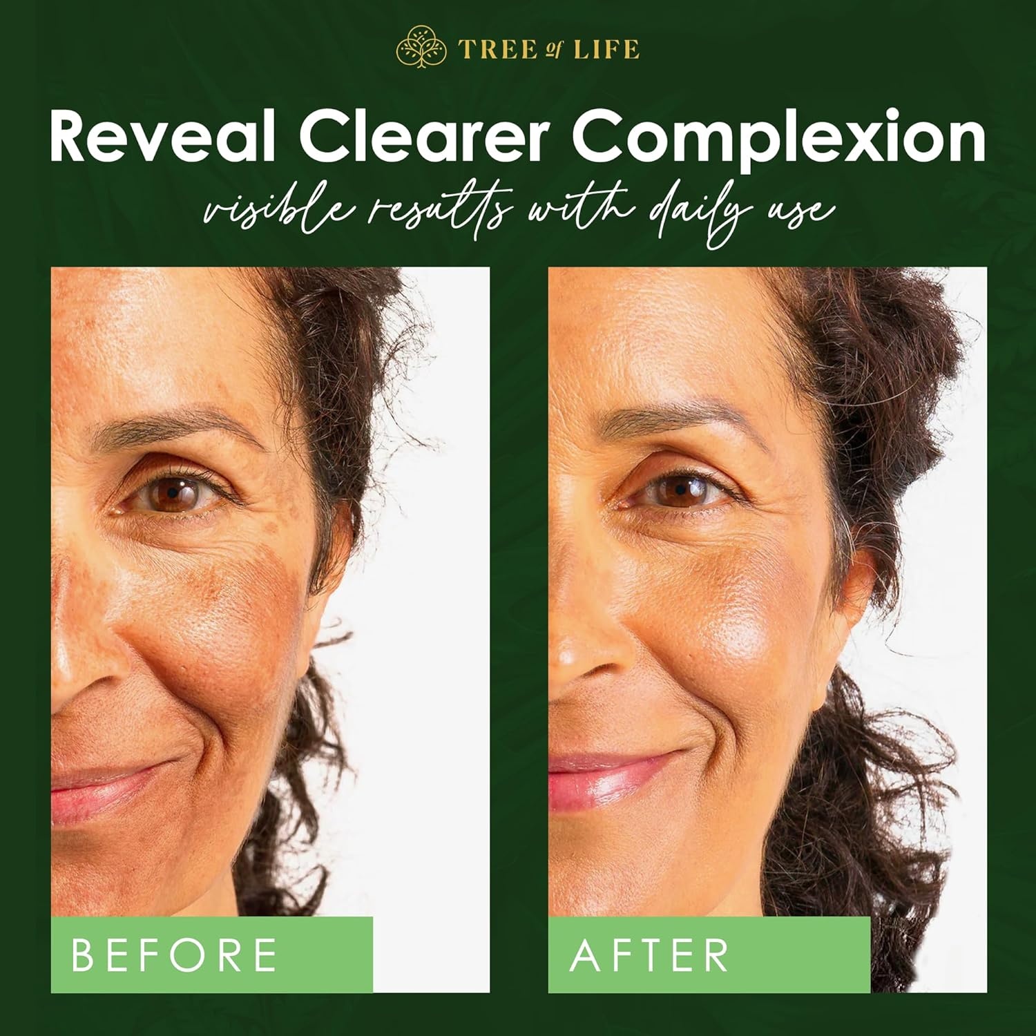 image:imageFacial Skin Care Set Brightening Firming Hydrating Dry Face Dermatologist Tested Retinol Serum and Hydrating Hyaluronic Acid Skin Care Kit 2 count of 1 Fl OzComplete Hydration Trio