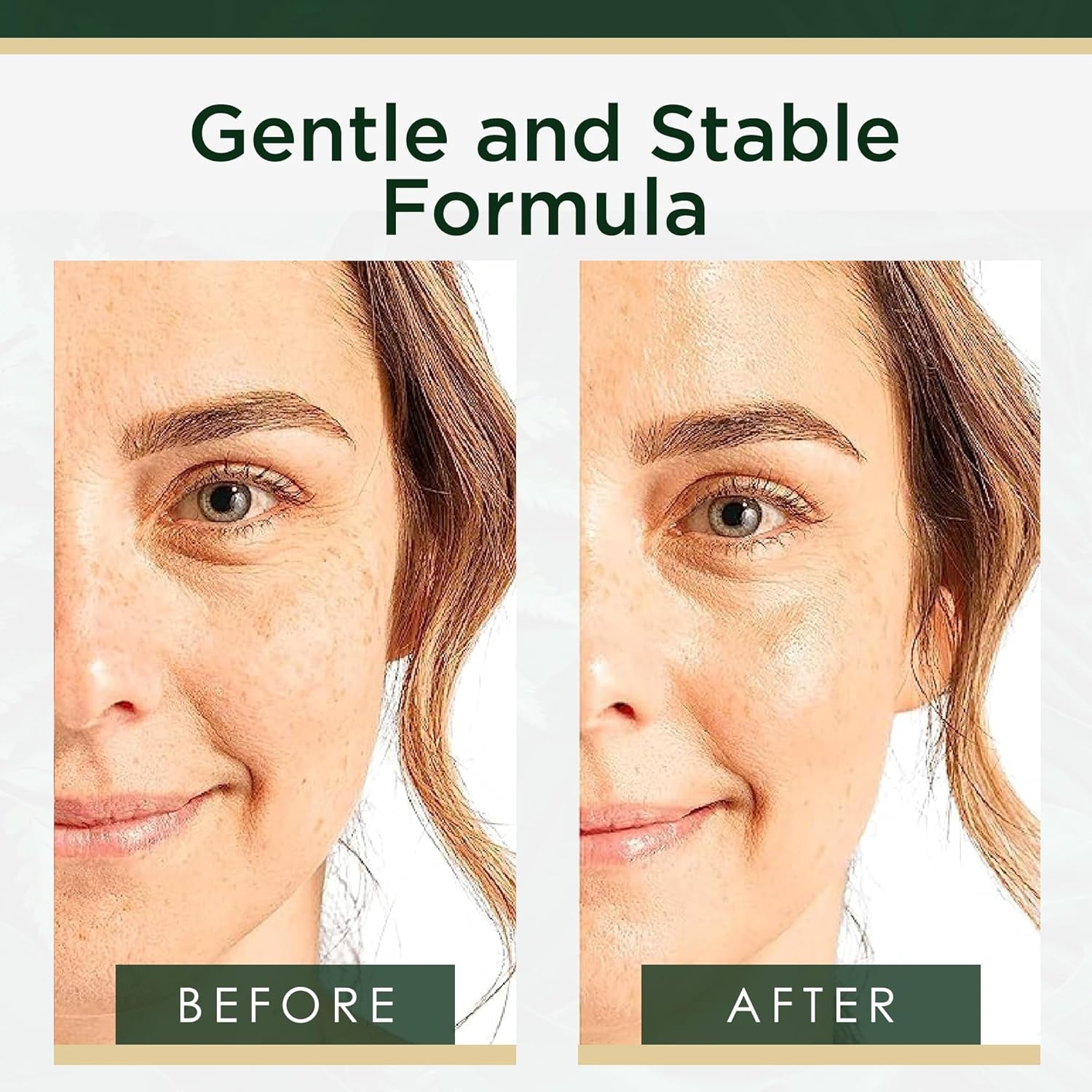image:imageMoisturizer Face Cream DermatologistTested Ultra Hydrating AntiAging Cream Reduces Dark Spots amp Fine Lines Brightens for Firmer Smoother Skin NonGreasy 4 Fl OzMatrixyl 3000