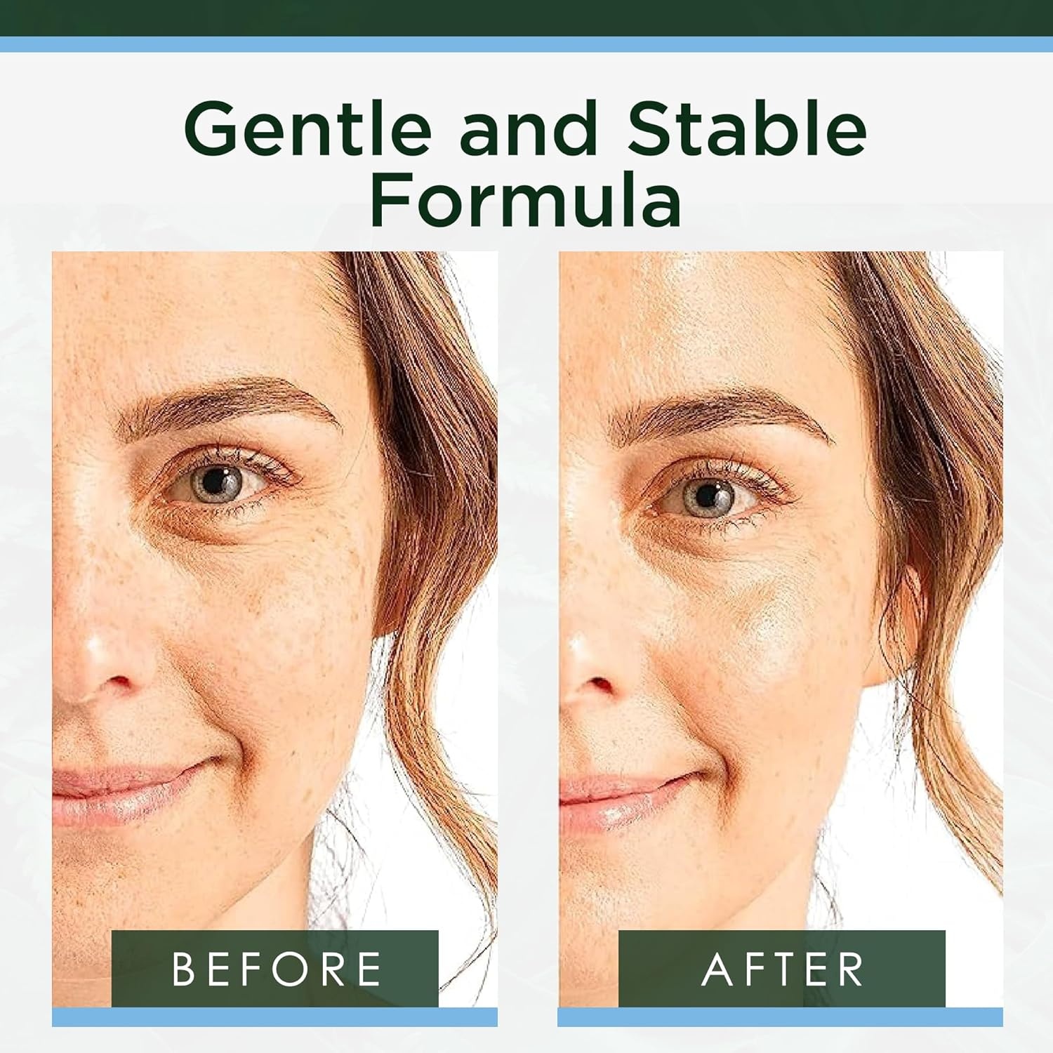 image:imageTree of Life Beauty Ultimate Skin Care Set Brightening Firming Hydrating Moisturizing Brightening Complete Face Care Regimen AntiAging Vitamin C Trio Pro PackTotal Hyaluronic Acid Serum Collection