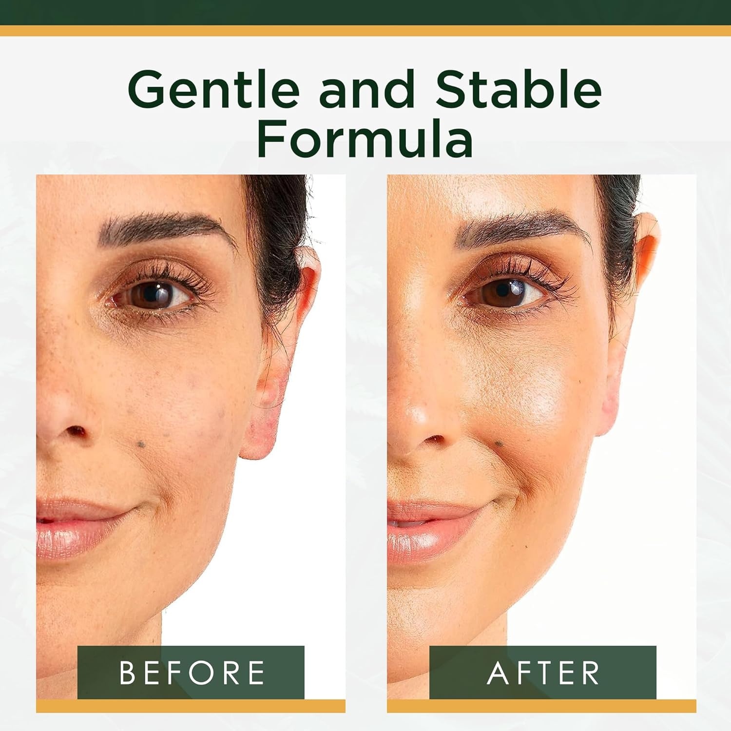 image:imageTree of Life Beauty Ultimate Skin Care Set Brightening Firming Hydrating Moisturizing Brightening Complete Face Care Regimen AntiAging Vitamin C Trio Pro PackTotal Vitamin C Face Serum Collection 5pack