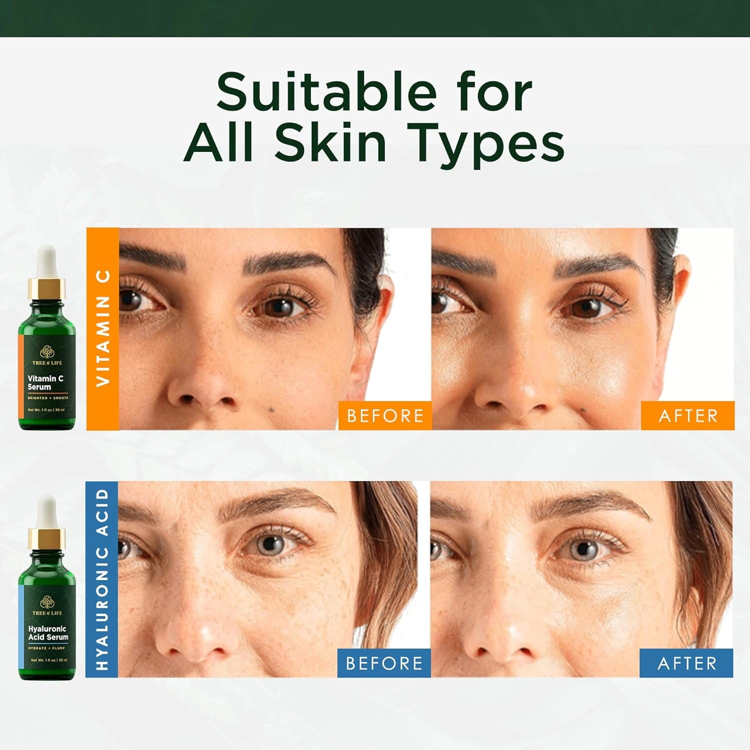 image:imageTree of Life Vitamin C Serum For Face Brightening Face Oil for Dark amp Age Spots For Dry amp Sensitive Skin with Vitamin E for Soft Smooth Glow Dermatologist Tested 1 Fl Oz07 Serum Set