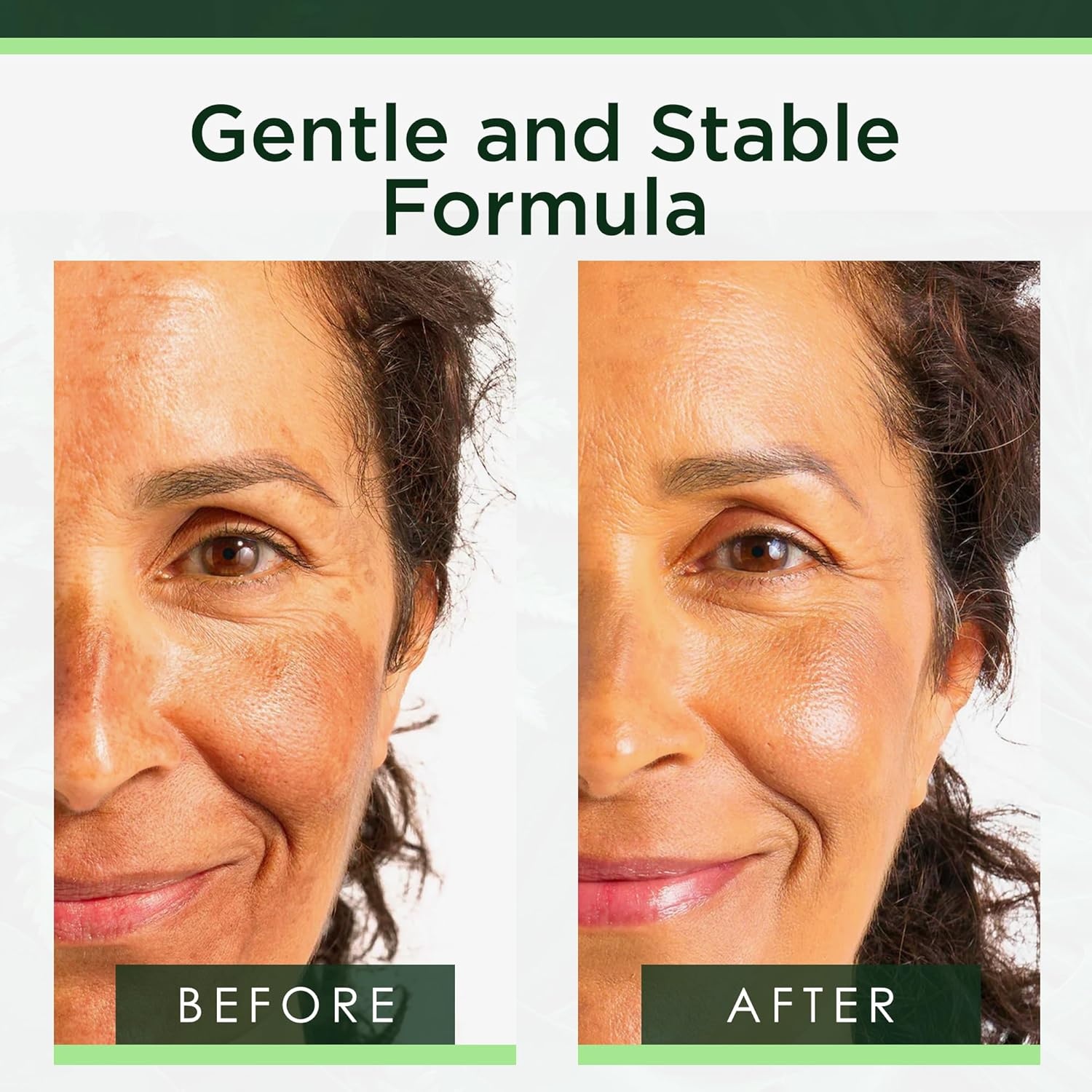 image:imageTree of Life Vitamin C Serum For Face Brightening Face Oil for Dark amp Age Spots For Dry amp Sensitive Skin with Vitamin E for Soft Smooth Glow Dermatologist Tested 1 Fl Oz04 Niacinamide