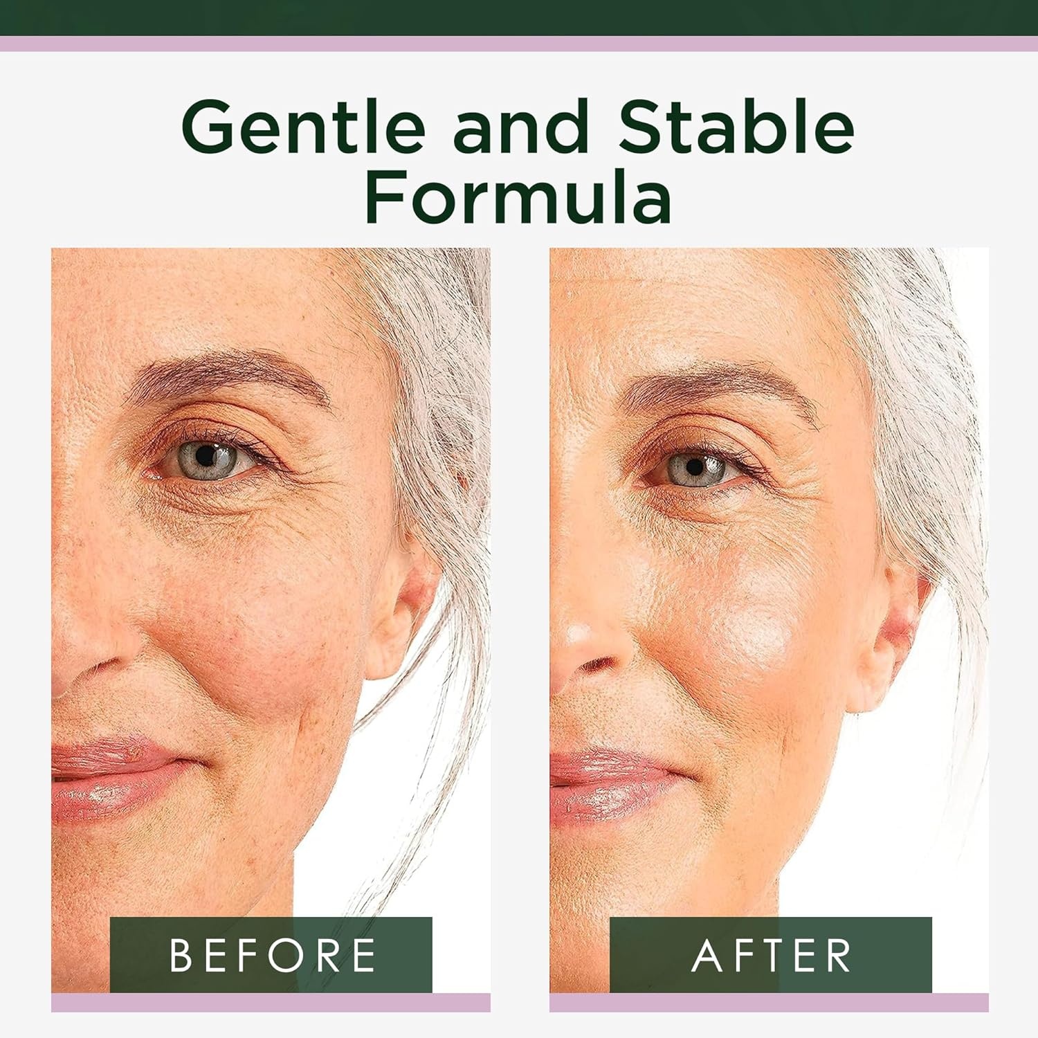 image:imageTree of Life Vitamin C Serum For Face Brightening Face Oil for Dark amp Age Spots For Dry amp Sensitive Skin with Vitamin E for Soft Smooth Glow Dermatologist Tested 1 Fl Oz03 Retinol Serum