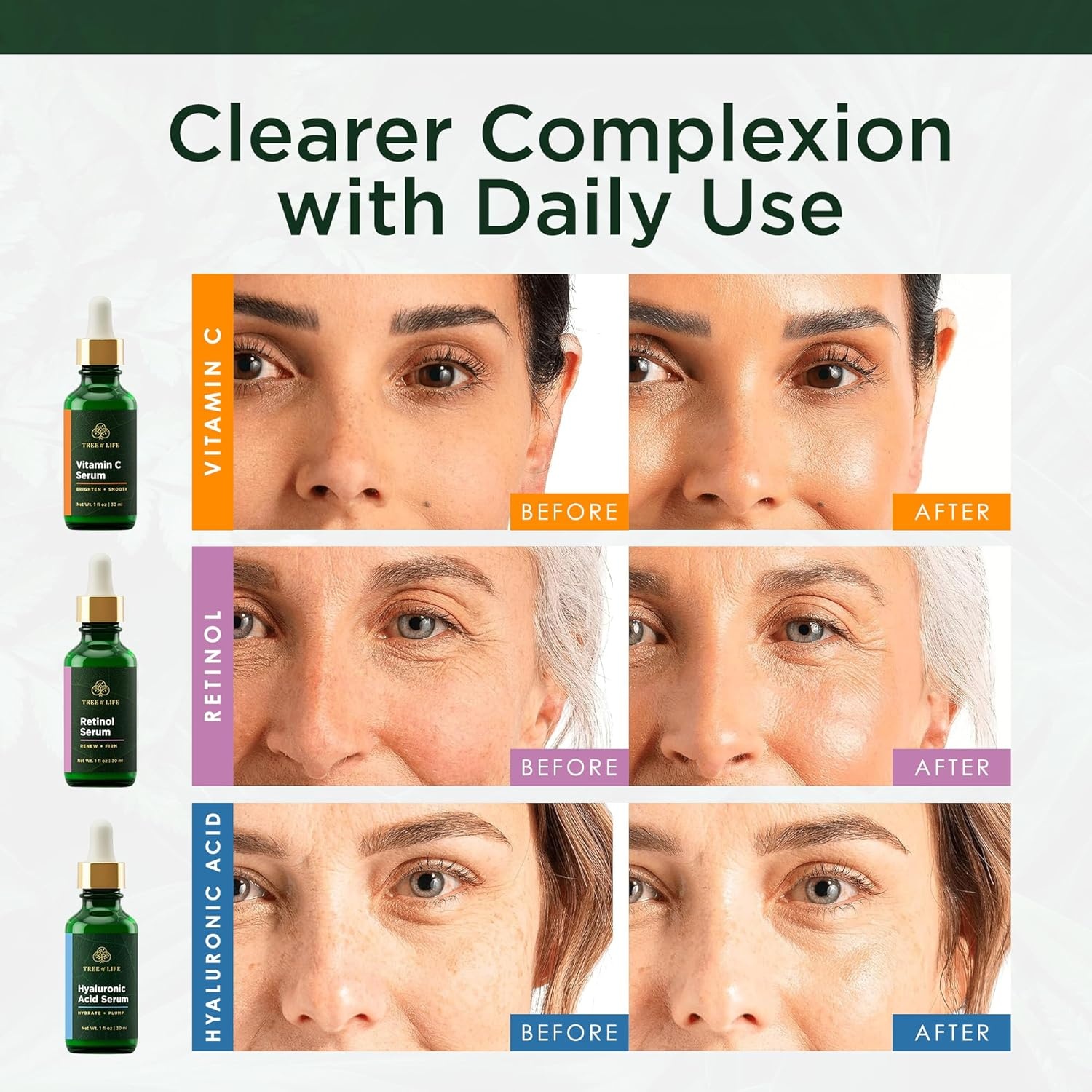 image:imageTree of Life Vitamin C Serum For Face Brightening Face Oil for Dark amp Age Spots For Dry amp Sensitive Skin with Vitamin E for Soft Smooth Glow Dermatologist Tested 1 Fl Oz07 Serum Set