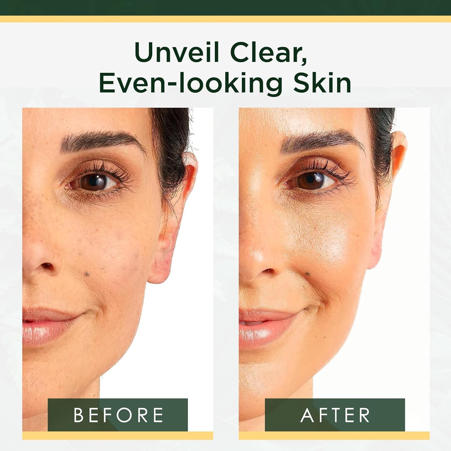 image:imageTree of Life Vitamin C Serum For Face Brightening Face Oil for Dark amp Age Spots For Dry amp Sensitive Skin with Vitamin E for Soft Smooth Glow Dermatologist Tested 1 Fl Oz06 Tranexamic Acid
